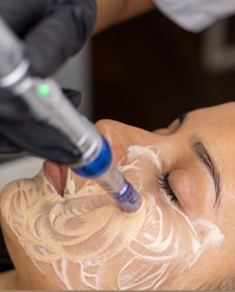 Aplicación de BB Glow con dermapen en MakeupMe Studio Barranquilla