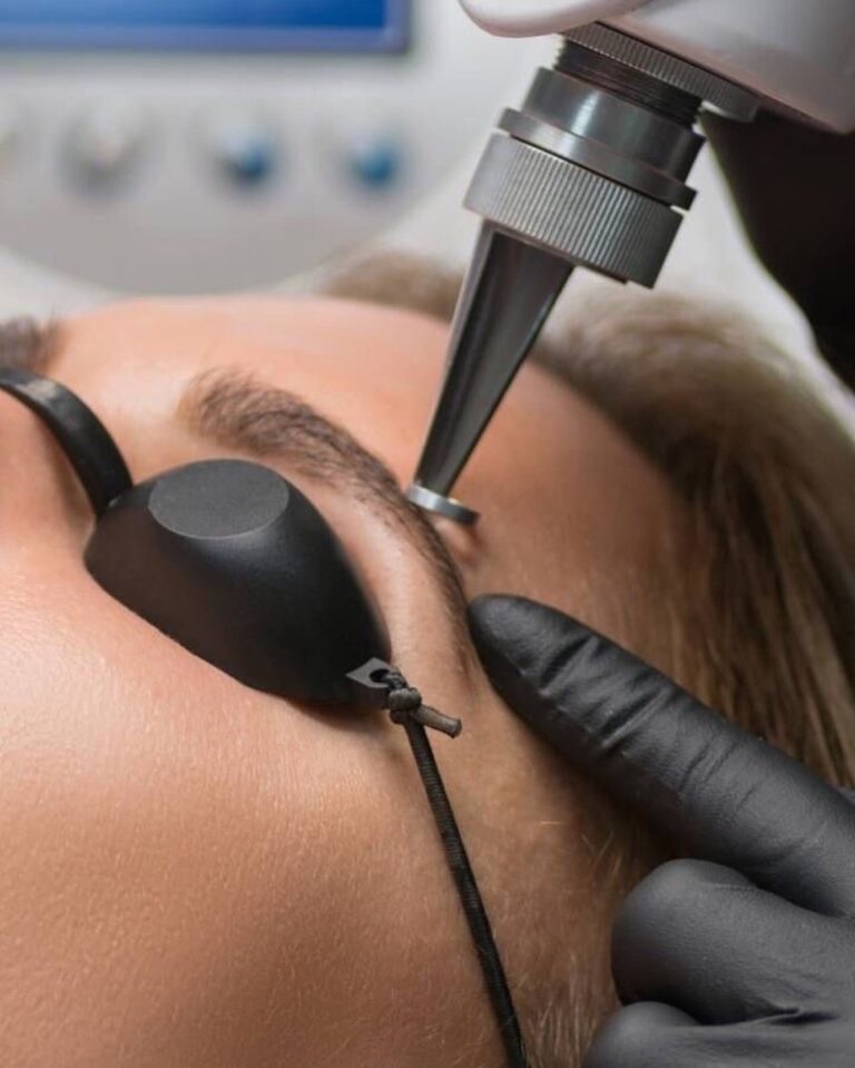 Remoción de pigmento de cejas en MakeupMe Studio